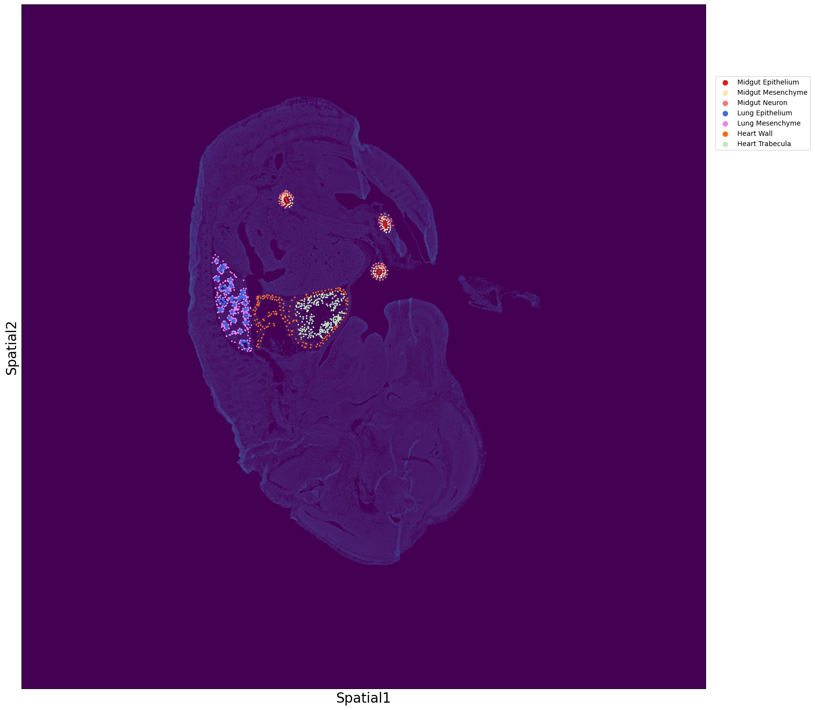 ../_images/Tutorials_Visualization_of_Nanostring_DSP_subtissues_16_1.png